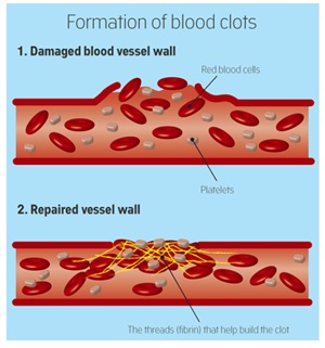 Blood Clotting - Optimize IAS