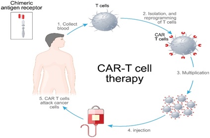 CAR-T therapy - Optimize IAS